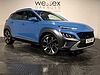 Hyundai KONA Ultimate T-Gdi Mhev Blue