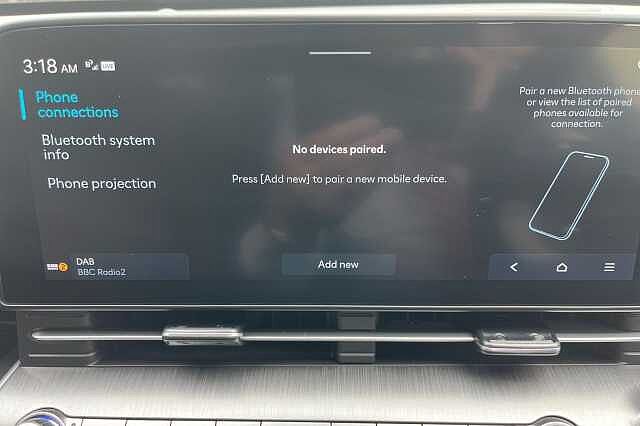 Hyundai KONA 1.0T Ultimate 5dr DCT