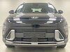 Hyundai KONA 1.6T 138 Advance 5dr BLACK